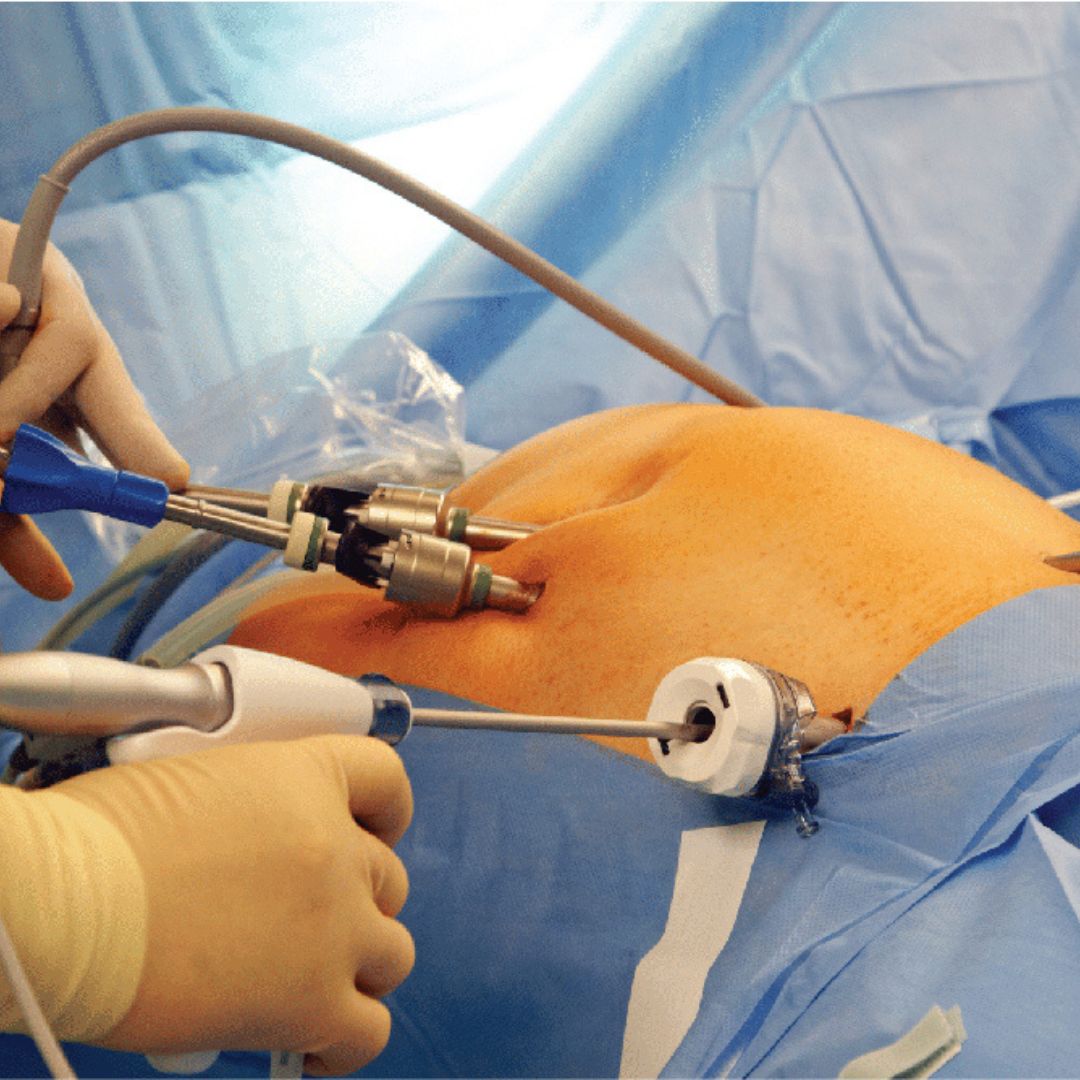 General Surgery