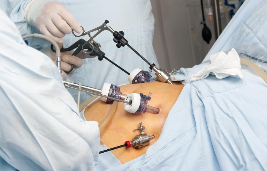 Gastric Bypass - Service Image