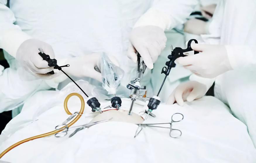 Laparoscopic Gastrectomy for Gastric Cancers