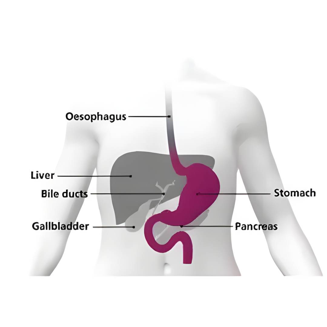 Upper GI Surgery